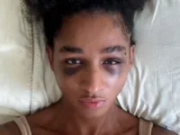 Espancadas e humilhadas: mulheres sofrem transfobia brutal no RJ