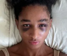Espancadas e humilhadas: mulheres sofrem transfobia brutal no RJ