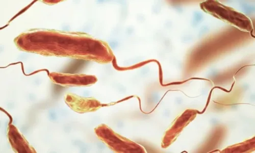 
				
					Cólera: saiba o que é, sintomas, transmissão e como se prevenir
				
				