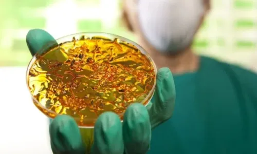 
				
					C�lera: saiba o que �, sintomas, transmiss�o e como se prevenir
				
				