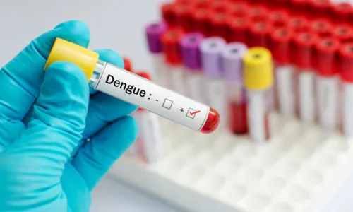 

					Dengue na Bahia: mortes sobem para 21 e 285 cidades estão em epidemia

				