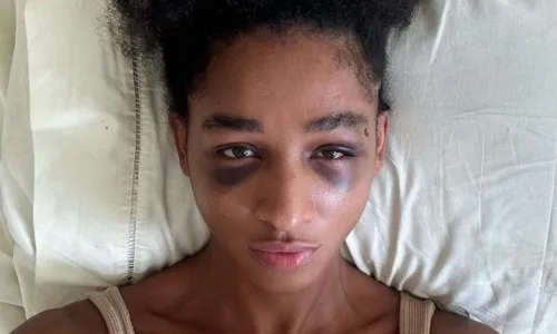 
				
					Espancadas e humilhadas: mulheres sofrem transfobia brutal no RJ
				
				