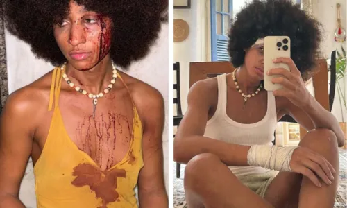 Espancadas e humilhadas: mulheres sofrem transfobia brutal no RJ