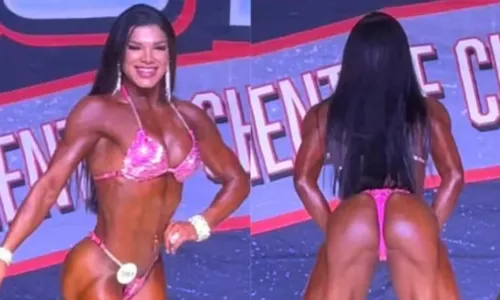  Ex-Tchan faz exame para mostrar que bumbum é natural após polêmica 