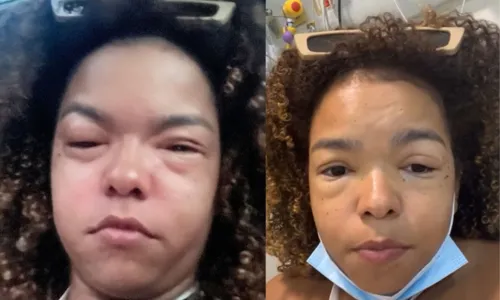 

					FOTOS: Jeniffer Nascimento é internada após reação alérgica 'severa'

				