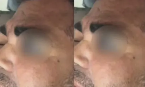  				 					Guardas municipais são suspeitos de agredir homem no sudoeste da Bahia 				 				