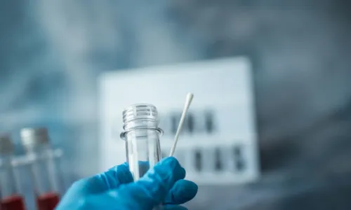  Norovírus, oropouche ou dengue? Diferencie a virose de outras doenças 