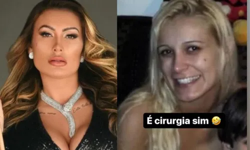 
				
					Andressa Urach choca ao mostrar rosto antes de procedimentos estéticos
				
				