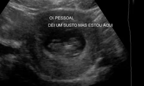 
				
					Lumena relata aborto espontâneo na web: 'Mãe por alguns poucos meses'
				
				