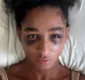 
                  Espancadas e humilhadas: mulheres sofrem transfobia brutal no RJ