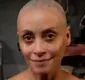 
                  Suzana Pires impressiona ao raspar cabeça para personagem com câncer