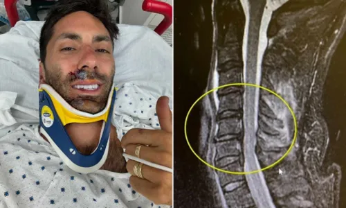 
				
					Apresentador de TV quebra pescoço após ser atropelado; veja fotos
				
				