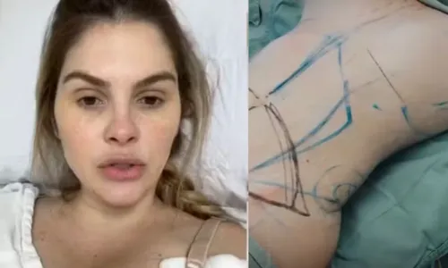 
				
					Bárbara Evans ostenta corpo novo após várias cirurgias plásticas
				
				