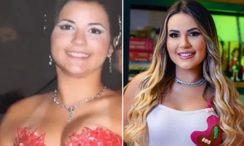 
				
					Deolane Bezerra: veja o antes e o depois da advogada ficar famosa
				
				