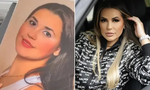 
				
					Deolane Bezerra: veja o antes e o depois da advogada ficar famosa
				
				