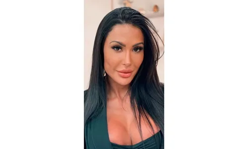 
				
					Gracyanne Barbosa remove preenchimentos faciais; veja antes e depois
				
				