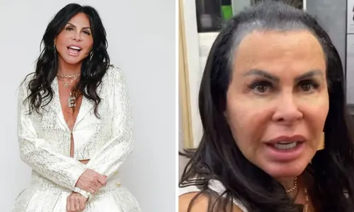 
				
					Gretchen surpreende ao aparecer na web sem prótese capilar; VÍDEO
				
				