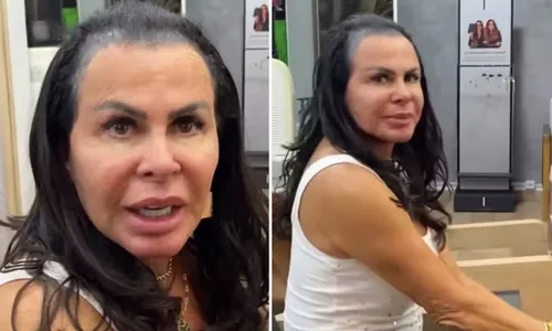 
				
					Gretchen surpreende ao aparecer na web sem prótese capilar; VÍDEO
				
				