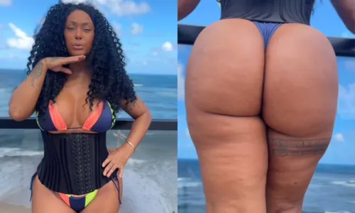 
				
					Rosiane Pinheiro exibe novo bumbum GG após lipo; veja vídeo
				
				