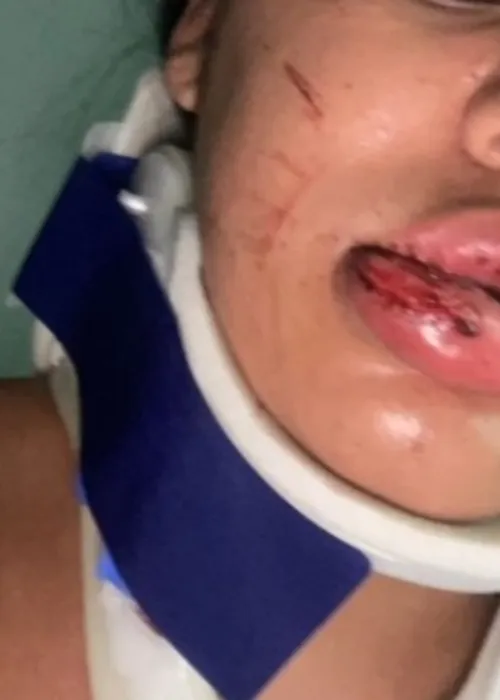 
				
					Mulher pula de moto para escapar de agressão do marido em Ilhéus
				
				