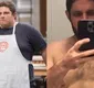 
                  Ex-Masterchef exibe antes e depois após perder 83 kg: 'Sem cirurgia'