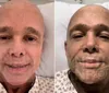 Cantor Netinho volta ao hospital e detalha transplante de medula