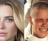 Carolina Dieckmann surpreende com revelação sobre fase careca: 'Boba'