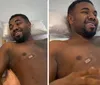 Davi Brito mostra a barriga após Lipo HD: 'Me sentindo Léo Santana'