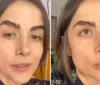 Maria Casadevall descobre síndrome rara e passa por cirurgia