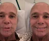 Netinho atualiza estado de saúde e revela transplante de medula óssea