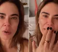 Luciana Gimenez desabafa sobre saúde após cirurgia: 'Frustrante'