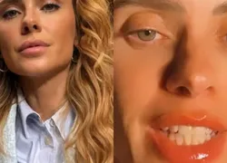 Carolina Dieckmann sofre reação alérgica após visitar Preta Gil