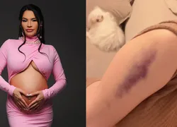 Grávida, Raissa Barbosa desabafa de quadro de saúde após acidente