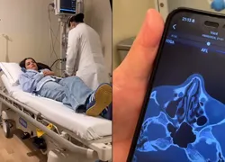 Juliette para no hospital após sofrer fratura em acidente doméstico