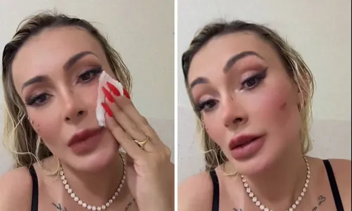 
				
					Andressa Urach tem rosto cortado em briga com Juju Ferrari; vídeo
				
				