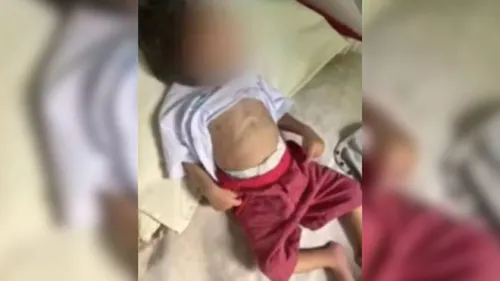 
				
					Bebê morre em hospital com desnutrição e marcas de agressão na Bahia
				
				