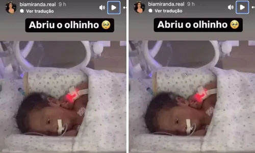 
				
					Bia Miranda comemora reação da filha em UTI e revela rosto do bebê
				
				