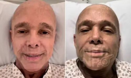 
				
					Cantor Netinho volta ao hospital e detalha transplante de medula
				
				