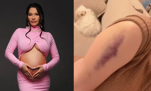 
				
					Grávida, Raissa Barbosa desabafa de quadro de saúde após acidente
				
				