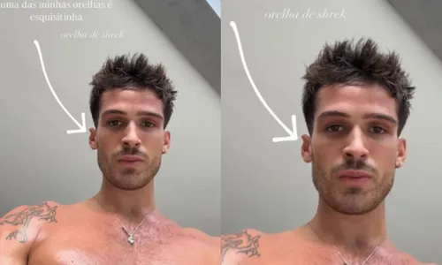 
				
					João Guilherme revela imperfeição no corpo após término com Marquezine
				
				