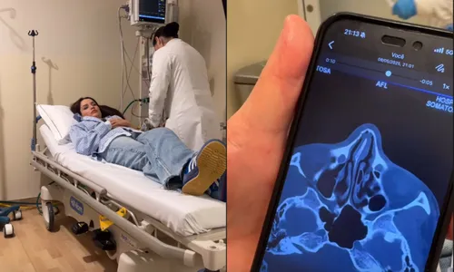 
				
					Juliette para no hospital após sofrer fratura em acidente doméstico
				
				