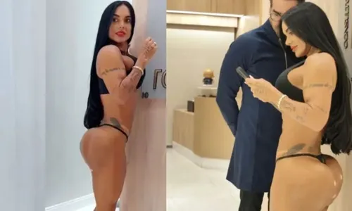 
				
					Kamila Simioni corrige bumbum após complicação e resultado impressiona
				
				