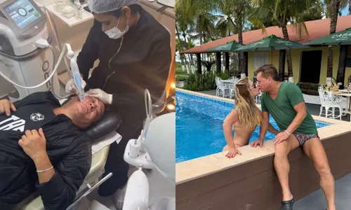 
				
					Leonardo se rende a pedido da esposa e faz procedimento novo estético
				
				