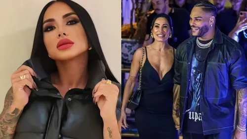 
				
					Kamila Simioni corrige bumbum após complicação e resultado impressiona
				
				