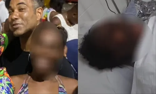 
				
					Mulher é incendiada durante discussão na Bahia; companheiro é suspeito
				
				