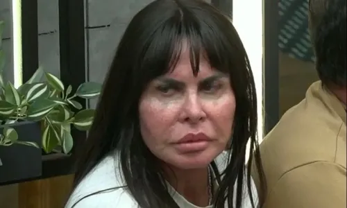 
					Gretchen reverte harmonização facial e emagrece 10 kg; antes e depois
				
				