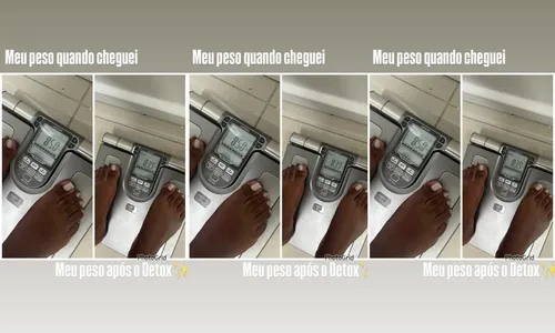 
					Raquel Brito rebate críticas após procedimento estético: 'Corpo real'
				
				