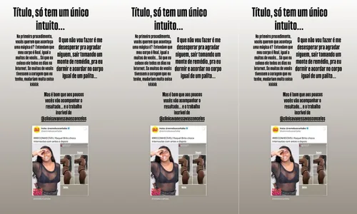 
					Raquel Brito rebate críticas após procedimento estético: 'Corpo real'
				
				