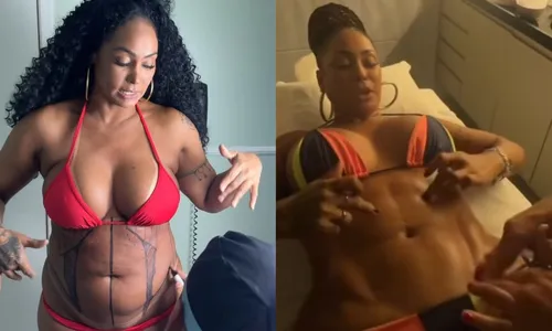 
				
					Rosiane Pinheiro choca ao mostrar antes e depois de lipoaspiração
				
				