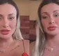 
                  Andressa Urach sofre golpe milionário e desabafa nas redes sociais